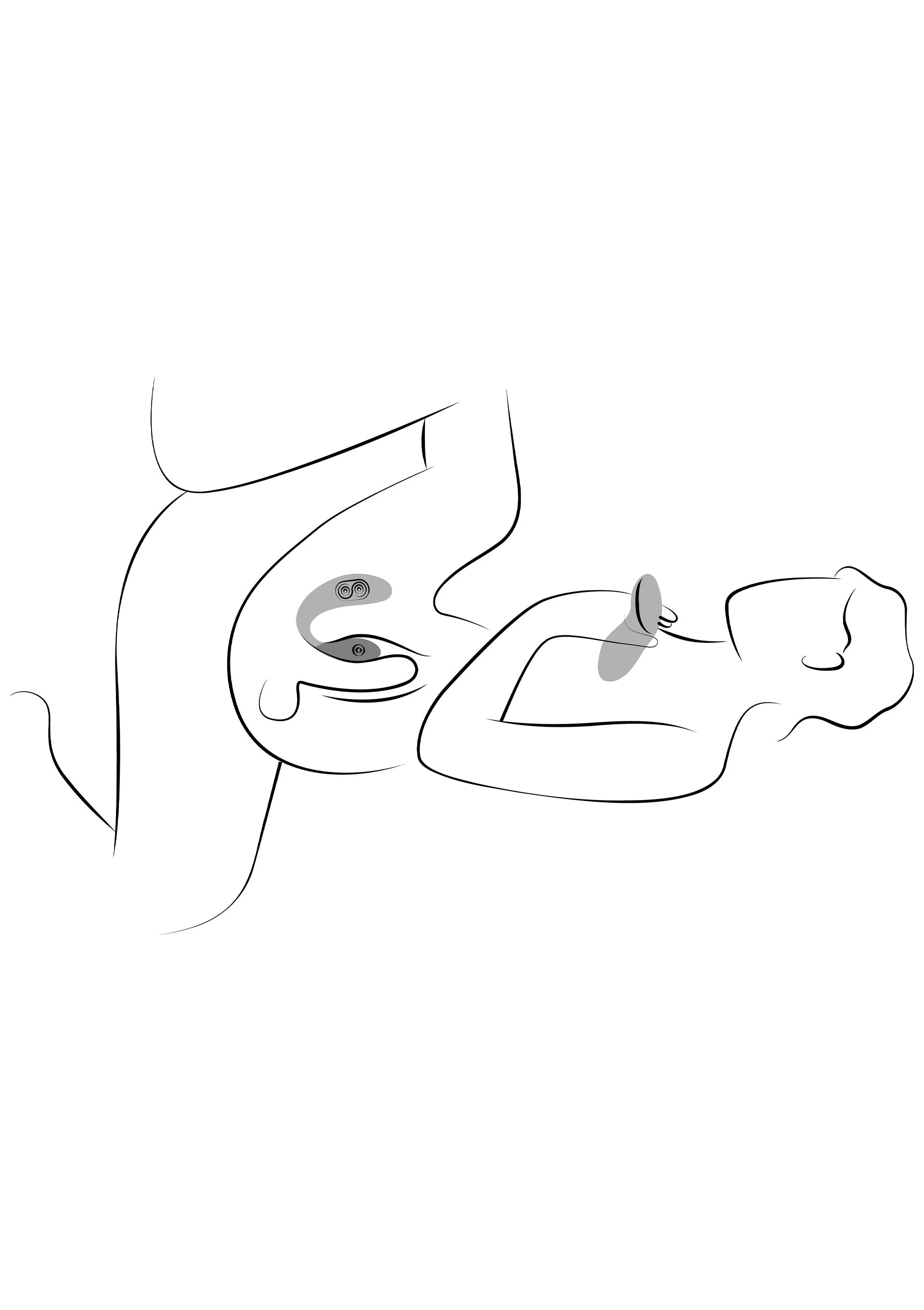 Chorus Pro van We-Vibe, gebruiksillustratie van koppelvibrator op lichaam